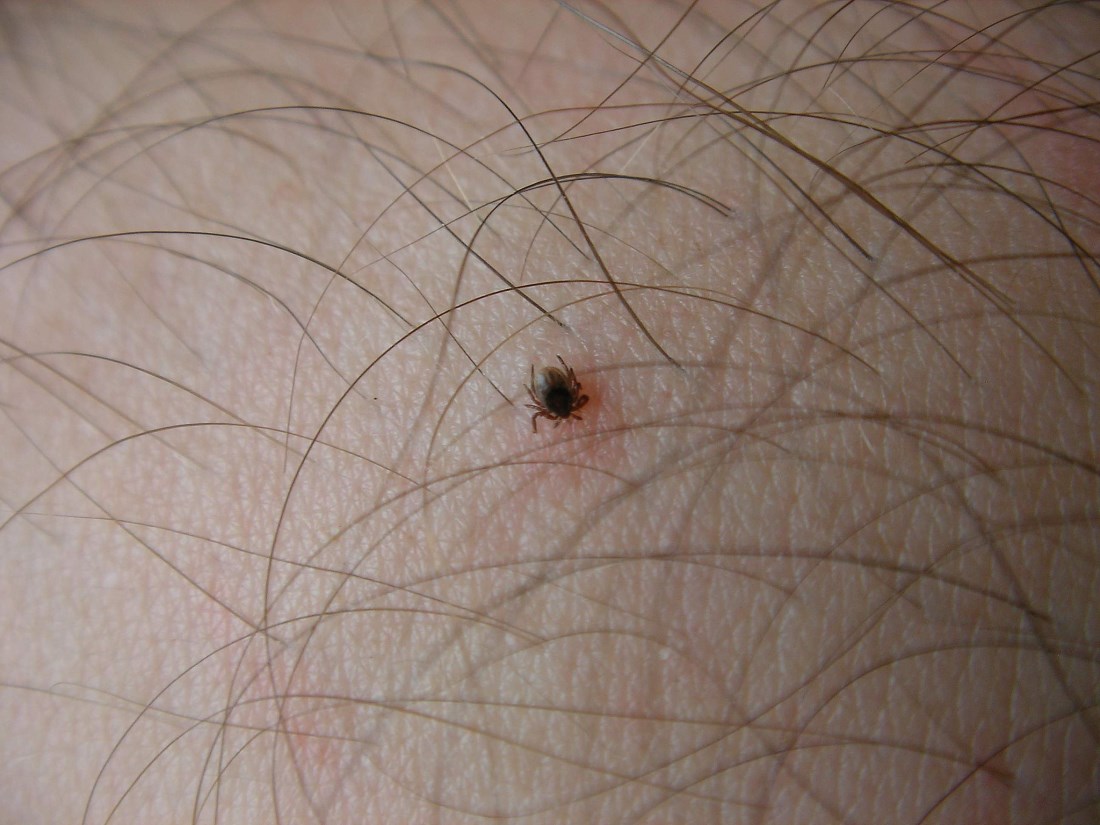 zecca corpo umano